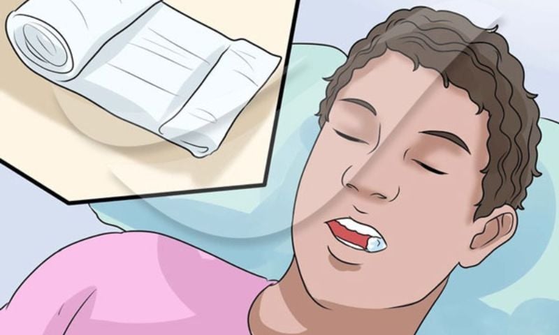 Những mẹo cầm máu sau khi nhổ răng bạn nên biết
