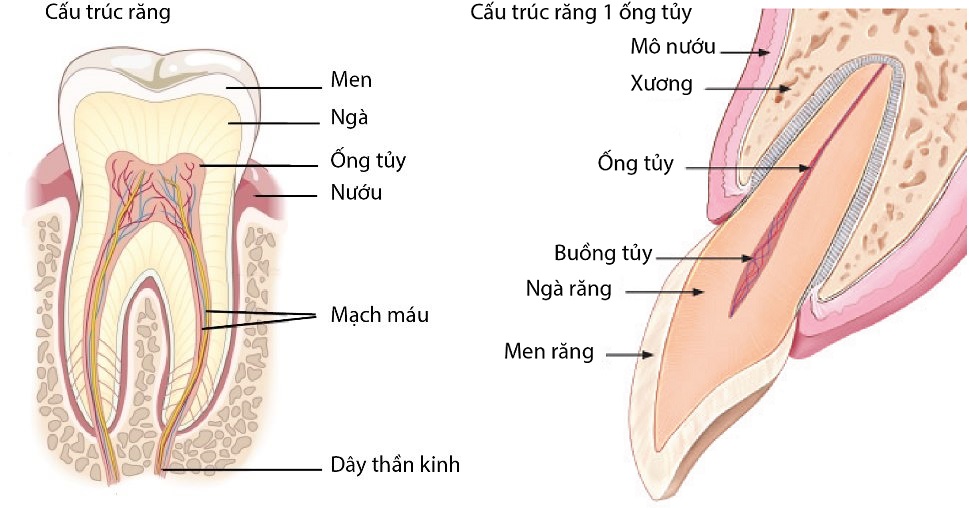 Những cách trị viêm tủy răng tại nhà đơn giản