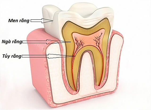 Những cách trị viêm tủy răng tại nhà đơn giản