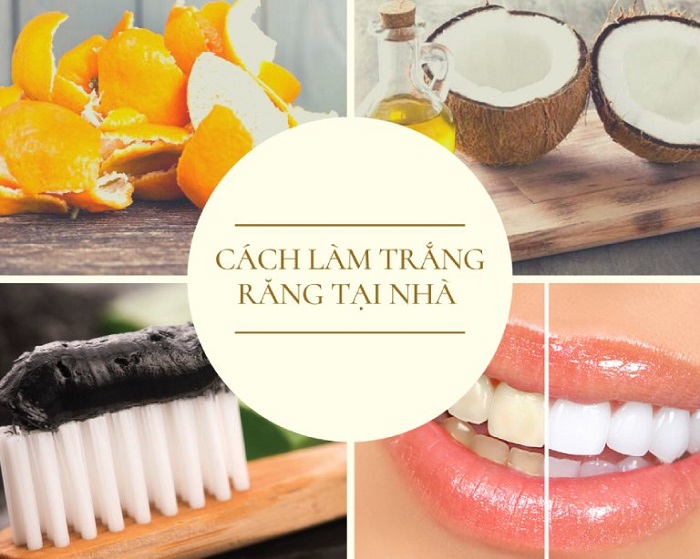 Những cách làm trắng răng tại nhà hiệu quả